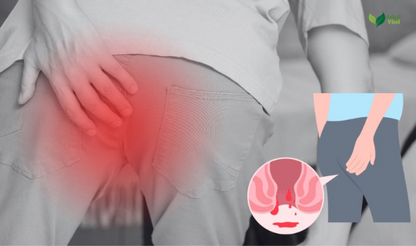 NATURAL RELIEF  Lo mejor contra las hemorroides