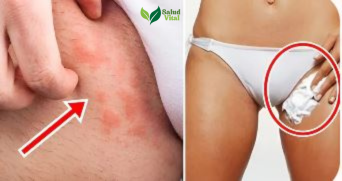 Depiladora Laser SuaviTouch™